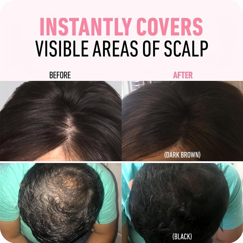 🔥BUY 1 GET 1 FREE💗Hairline Powder (fit all hair color)