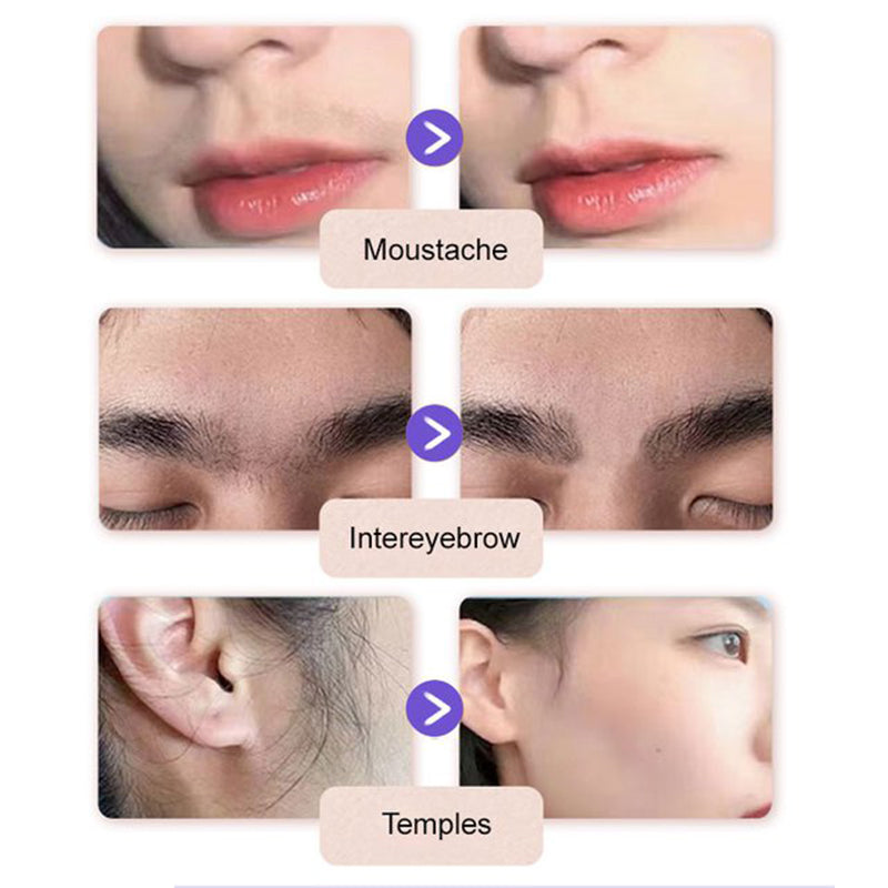 🔥2025 HOT SALE 60% OFF🐇Gentle & Painless Facial Hair Removal Cream